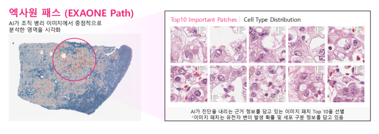 엑사원 패스는 전체 슬라이드 이미지(WSI)에서 암과 관련된 유전자 변이를 예측할 수 있다. 사진=LG