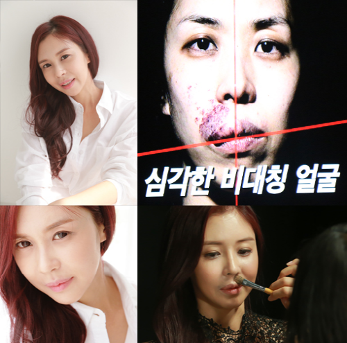 사진/ 케이블TV스토리온 렛미인4 '반쪽으로 사는 여자'캡쳐화면